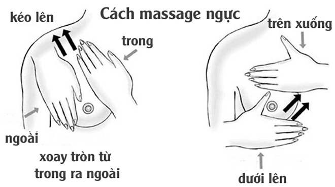 Viêm tuyến vú do tắc tia sữa